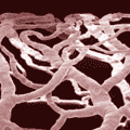 Polymer cast, vasa vasorum rat carotid sinus Donald M. McDonald, UCSF
