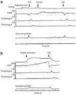 Figure 11 : Effect of pharyngeal water injection on UES resting pressure. Unfortunately we are unable to provide accessible alternative text for this. If you require assistance to access this image, or to obtain a text description, please contact npg@nature.com