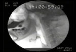 Video 2 : Comparison of primary and pharyngeal reflexive swallow. Unfortunately we are unable to provide accessible alternative text for this. If you require assistance to access this image, or to obtain a text description, please contact npg@nature.com