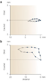 Figure 11 : Movement of the hyoid bone during belching (a) and swallowing (b). Unfortunately we are unable to provide accessible alternative text for this. If you require assistance to access this image, or to obtain a text description, please contact npg@nature.com