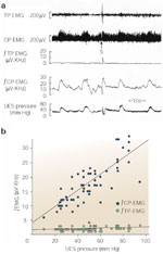 Figure 7 : Relationship of CP and TP|[emsp]|EMG activities to UES pressure during rest and excitation. Unfortunately we are unable to provide accessible alternative text for this. If you require assistance to access this image, or to obtain a text description, please contact npg@nature.com