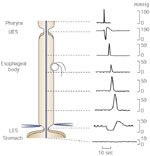 Figure 1 : Primary peristalsis as recorded by an intraluminal manometry catheter. Unfortunately we are unable to provide accessible alternative text for this. If you require assistance to access this image, or to obtain a text description, please contact npg@nature.com