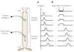 Figure 3 : Schematic representation of esophageal contractions. Unfortunately we are unable to provide accessible alternative text for this. If you require assistance to access this image, or to obtain a text description, please contact npg@nature.com