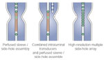 Figure 1 : Schematic representation of various options for manometric recording configurations for pharyngoesophageal manometry. Unfortunately we are unable to provide accessible alternative text for this. If you require assistance to access this image, or to obtain a text description, please contact npg@nature.com