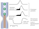 Figure 6 : Schematic depiction of the various elements of pharyngoesophageal motility analysis. Unfortunately we are unable to provide accessible alternative text for this. If you require assistance to access this image, or to obtain a text description, please contact npg@nature.com