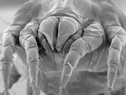 Around £700 million is spent every year on controlling house dust mites in the UK alone.