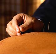 Needles are used in alternative therapy to treat illness, pain and even addiction.