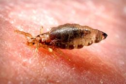 Body Lice Pictures, Images & Photos | Photobucket