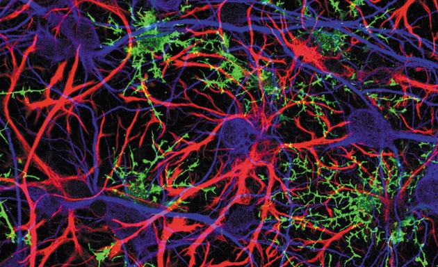 Glia_and_neurons.jpg