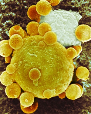 photo of Cancer cells can ‘infect’ normal neighbours image