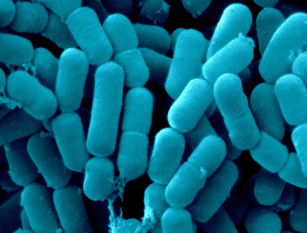 photo of GM microbes created that can’t escape the lab image