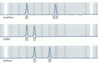 Three electrophoresis gel diagrams show which isozymes are shared between three family members. Each gel looks like a long horizontal grey rectangle with smaller vertical gray and white rectangles superimposed. A blue line that looks like a chromatogram is superimposed on each gel and represents individual isozyme locations on the gel. The mother’s gel at top has a marker at points 6 and 9.3. The child’s gel in the middle diagram has a marker at points 6 and 7. The alleged father’s gel at bottom has a marker at points 7 and 9.