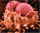 A photomicrograph shows two spherical bacterial cells cradled in a depression at the top of two epithelial cells. The epithelial cells appear fluorescent orange and look like spheres with short cilia-like protrusions. The bacterial cells, which appear fluorescent pink, have small bumps covering their surfaces.