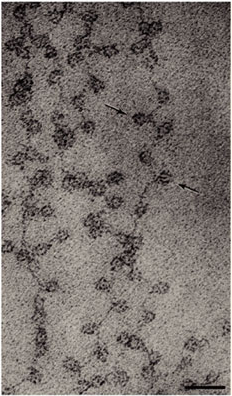 A greyscale electron micrograph shows chromatin in an extended form, which resembles beads on a string. The beads are nucleosomes, and the string is DNA. Each nucleosome looks like a small black circle. Many circles are visible on alternating sides of a long string of DNA. Two nucleosomes are indicated with black arrows. A scale bar represents 30 nanometers. Each nucleosome is approximately 10 nanometers in diameter.