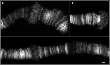 Three photomicrographs show polytene chromosomes. The chromosomes look like horizontal tubes composed of white, grey, and black bands against a black background. They look like thick, striated lengths of rope.