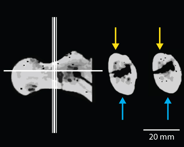 CT-scans of the femoral neck of BAR 1002′00, a specimen of Orrorin tugenensis.