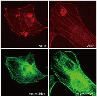 Photomicrographs of single cells are displayed in two rows, with two panels in each row. In the  top row are two examples of fluorescently-stained actin filaments inside single cells. The cells are irregularly-shaped polygons, and the actin filaments are arranged in parallel lines. The bottom row are microtubules, labeled in a fluorescent green color. The microtubules are arranged in a fan-like array, resembling spider webs.