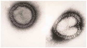 Two virus particles are shown in this black-and-white electron micrograph. The particle at left has a circular shape, enveloped in a two-layered ribbed membrane that appears as two concentric circles. The space between the two membrane layers is darker than the space inside the circle. The second particle, at right, is heart-shaped with the bottom pointing left, and is enclosed by the same two-layered envelope as the particle beside it.