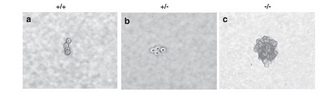The photomicrographs in panels A and B show normal, non-transformed mouse fibroblast cells that have formed aggregates of four cells. Each cells looks like a grey circle with a dark border, representing the plasma membrane, and a dark dot in the center, representing the nucleus. The photomicrograph in panel C shows transformed mouse fibroblast cells growing in a large, dense, oviform mass, in which the individual cells and their nuclei are indistinguishable. Panel A represents a cell with two wild-type copies of a tumor suppressor gene (+/+); panel B represents a cell that has a single wild-type copy of a tumor suppressor gene (+/-); and panel C represents a cell that lacks a functional copy of the tumor suppressor gene (-/-).