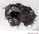 An electron micrograph shows an amoeba that has been invaded by a Mimivirus. A scale bar represents 2 microns, and the amoeba measures approximately 10 microns across. A circular, approximately 2-micron region in the amoeba's center is the nucleus. A darkly-shaded circular region of similar size is the viral factory. Congregating alongside the viral factory's border are approximately 20 Mimivirus virions. These are smaller, 0.5 to 1 micron circles, each with a circular black patch in its center. 2-4 virions are separated from the region surrounding the viral factory and scattered around the cell.