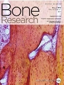 Bone Research