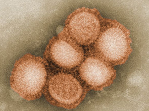 The H1N1 Virus Landing page