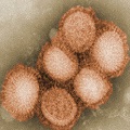 The H1N1 Virus
