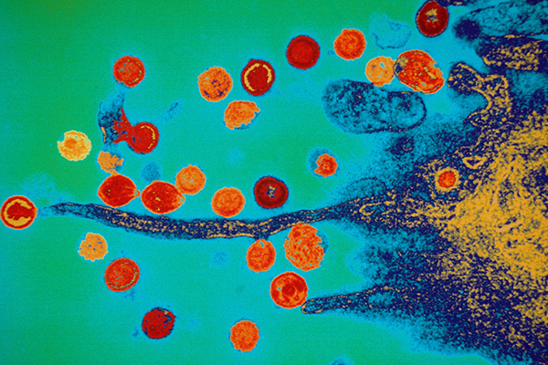 Color enhanced transmission electron micrograph TEM of an HIV virus budding out of an infected T-lymphocyte cell