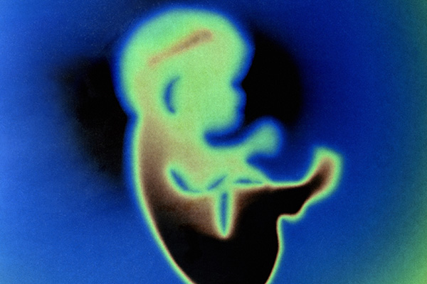 A human foetus