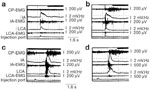 Figure 12 : Pharyngoglottal closure reflex: effect of pharyngeal water stimulation on myoelectrical activity. Unfortunately we are unable to provide accessible alternative text for this. If you require assistance to access this image, or to obtain a text description, please contact npg@nature.com