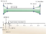 Figure 14 : Temporal relationship among function of the glottis, UES, hyoid bone, and esophageal and stomach pressures during belching induced by rapid injection of 40 mL of air into the esophagus. Unfortunately we are unable to provide accessible alternative text for this. If you require assistance to access this image, or to obtain a text description, please contact npg@nature.com