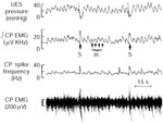 Figure 20 : Respiratory rhythm of the UES closure muscles. Unfortunately we are unable to provide accessible alternative text for this. If you require assistance to access this image, or to obtain a text description, please contact npg@nature.com