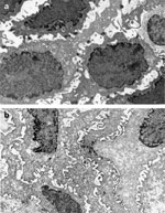 Figure 3 : Transmission electron micrographs of intercellular spaces. Unfortunately we are unable to provide accessible alternative text for this. If you require assistance to access this image, or to obtain a text description, please contact npg@nature.com