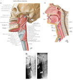 Figure 1 : Lateral sagittal views of the pharynx comparing line drawings with contrast radiographs at rest and during phonation. Unfortunately we are unable to provide accessible alternative text for this. If you require assistance to access this image, or to obtain a text description, please contact npg@nature.com