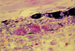 Figure 4 : Neurons in myenteric plexus of human esophagus. Unfortunately we are unable to provide accessible alternative text for this. If you require assistance to access this image, or to obtain a text description, please contact npg@nature.com