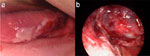 Figure 3 : Pharyngeal lye injection. Unfortunately we are unable to provide accessible alternative text for this. If you require assistance to access this image, or to obtain a text description, please contact npg@nature.com
