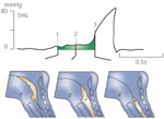 Figure 3 : Hypopharyngeal intrabolus pressure is an indirect measure of UES compliance. Unfortunately we are unable to provide accessible alternative text for this. If you require assistance to access this image, or to obtain a text description, please contact npg@nature.com