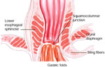 Figure 1 : The gastroesophageal junction. Unfortunately we are unable to provide accessible alternative text for this. If you require assistance to access this image, or to obtain a text description, please contact npg@nature.com