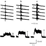 Figure 11 : The increasing pattern of adductor responses (upper) and integrated responses (lower) by 8-Hz stimulation of the superior laryngeal nerve (SLN) (0.6 V, 0.1 msec) under conditions of (a) pCO2 60 mmHg; (b) pCO2 40 mmHg; and (c) pCO2 25 mmHg. Unfortunately we are unable to provide accessible alternative text for this. If you require assistance to access this image, or to obtain a text description, please contact npg@nature.com