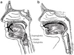 Figure 2 : The nasolaryngeal relationship. Unfortunately we are unable to provide accessible alternative text for this. If you require assistance to access this image, or to obtain a text description, please contact npg@nature.com