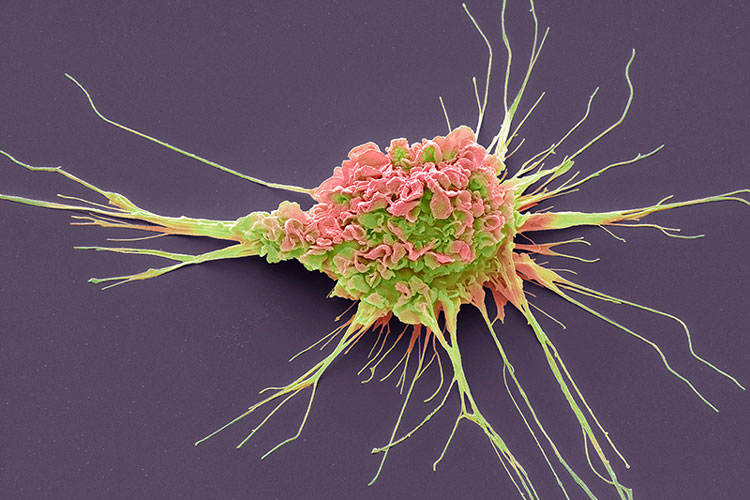 False coloured scanning electron micrograph of a dendritic cell