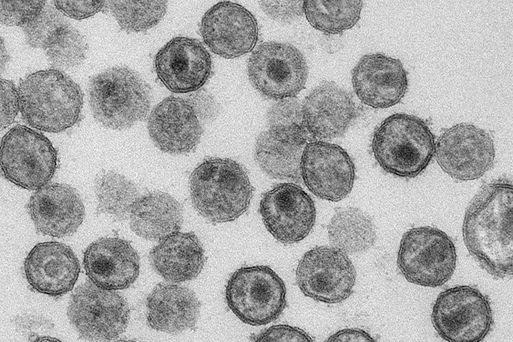 Transmission electron micrograph showing mature SIV particles