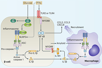 图显示了葡萄糖如何激活胰岛 β 细胞的炎性体以诱导炎症反应的分子机制，该反应涉及 T2D 后期巨噬细胞的募集。