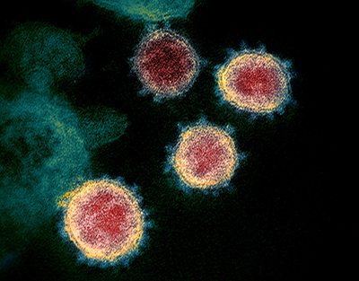 四种病毒颗粒 (SARS-CoV-2) 的电子透射显微镜图像。 病毒颗粒呈圆形，外面有尖刺。