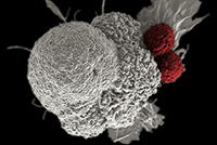 Coloured scanning electron micrograph of two red T cells bound to a grey cancer cell.