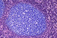 Coloured light micrograph of a section through a lymph node. Germinal centres have been highlighted in blue.