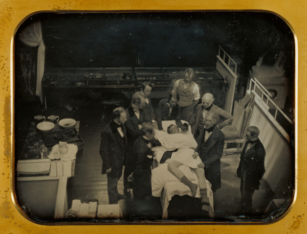 early operation using ether for anesthesia at Massachusetts General Hospital