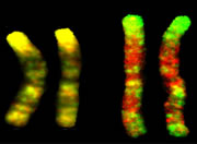 Chromosomes from 3-year-old twins (left) are virtually identical. But those from 50-year-old twins (right) show changes in gene expression in red and green.