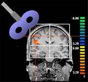 This fMRI highlights regions of the brain that control finger sensation