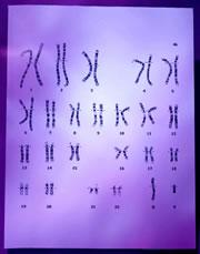 Our number one, and biggest, chromosome has now been sequenced.